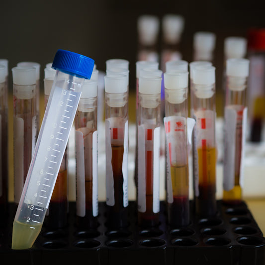 Hot Topic - Parkinson's breakthrough: Alpha-synuclein proteins and the gut-brain axis