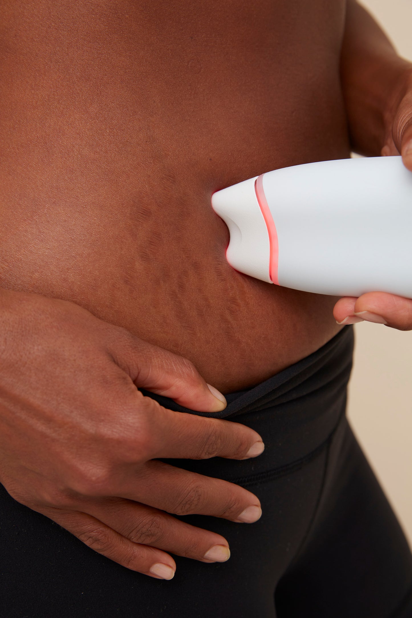 DermaCare-Laser