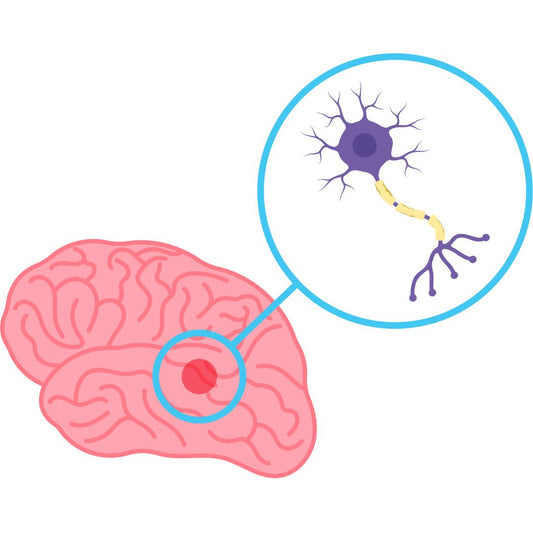 Parkinson's is a disorder of cellular health, not just low dopamine levels